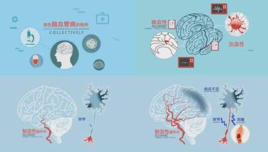 脑卒中医院血液出血病床健身运动MG高清AE视频素材下载