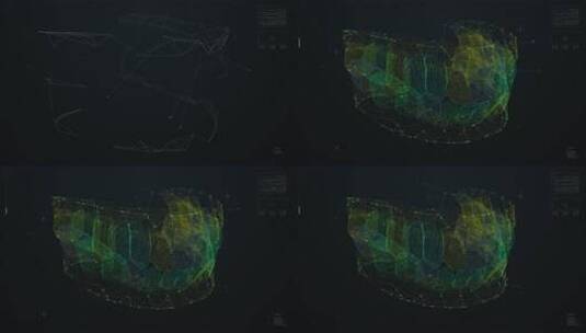 数字颌骨扫描。高级牙科可视化高清在线视频素材下载