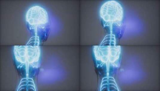 人脑放射学检查高清在线视频素材下载