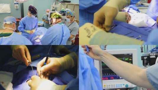 婴儿在医院接受手术高清在线视频素材下载