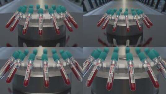  血液检测呈阳性分析试管高清在线视频素材下载