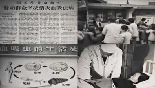 60年代 消灭血吸虫病高清在线视频素材下载