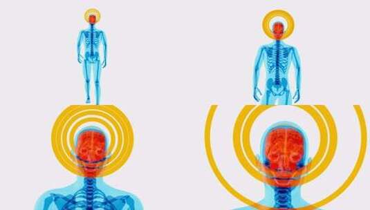 4KX射线人行走的解剖学概念高清在线视频素材下载