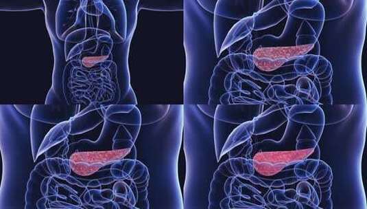 胰脏疾病高清在线视频素材下载