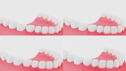 牙齿医疗模型三维动画高清在线视频素材下载