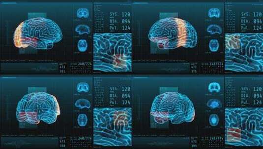 计算机屏幕显示的 3D大脑神经和生命体征高清在线视频素材下载