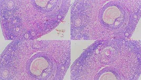 卵巢切片在光显微照片下放大40倍对着亮视高清在线视频素材下载