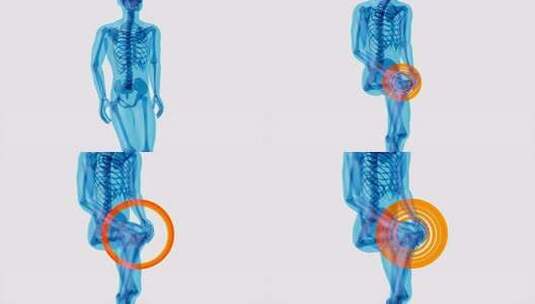 膝盖疼痛的4K解剖学概念高清在线视频素材下载