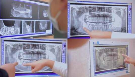 牙医牙科诊所高清在线视频素材下载