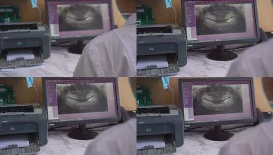 牙科 检查 医护 医生 蛀齿高清在线视频素材下载
