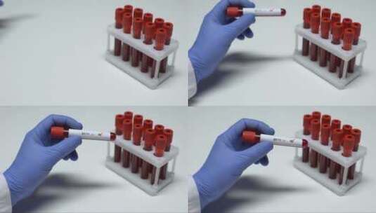 医生显示血样高清在线视频素材下载