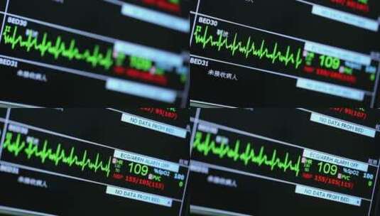 心率仪器数字特写高清在线视频素材下载
