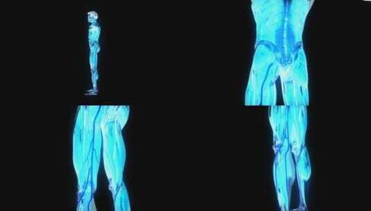 三维人体X光高清在线视频素材下载