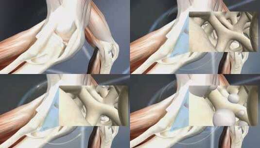 活血化瘀 风湿骨病 骨密度 软骨素氨糖高清在线视频素材下载