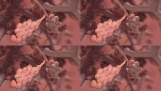 三维人体解剖微观慢性支气管炎肺充气肺泡高清在线视频素材下载