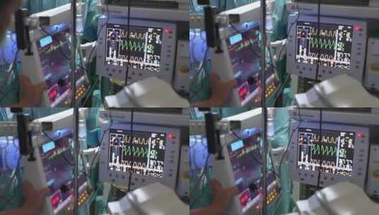 医院的心电图医疗仪器高清在线视频素材下载