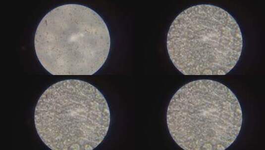 显微镜下精子运动高清在线视频素材下载