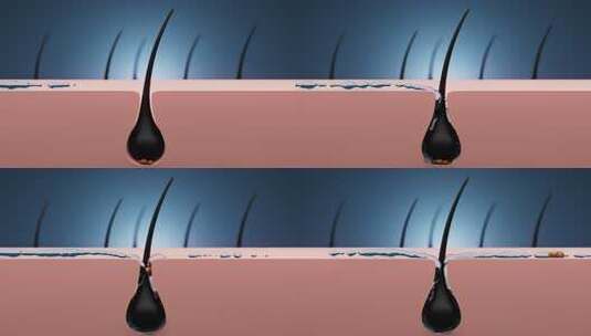 药物治疗毛发皮肤发囊炎4k高清在线视频素材下载