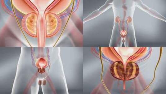 前列腺堵塞 前列腺毒素 排尿顺畅 尿道变窄高清在线视频素材下载