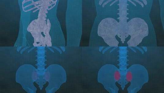 医学强健3D动画高清在线视频素材下载