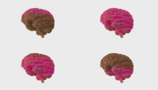 大脑、扫描、激光、科学高清在线视频素材下载