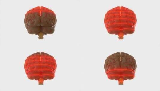 大脑、扫描、激光、科学高清在线视频素材下载