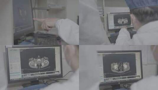 医生观察肺部ct高清在线视频素材下载