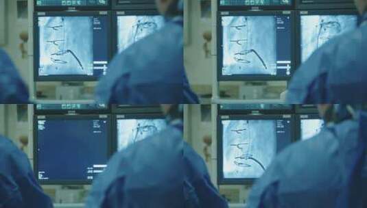 医生看监视器手术高清在线视频素材下载