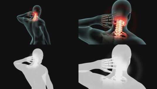 颈部疼痛高清在线视频素材下载