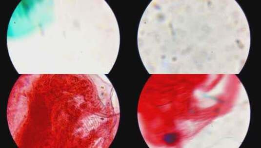 显微镜观察水蚤微生物高清在线视频素材下载