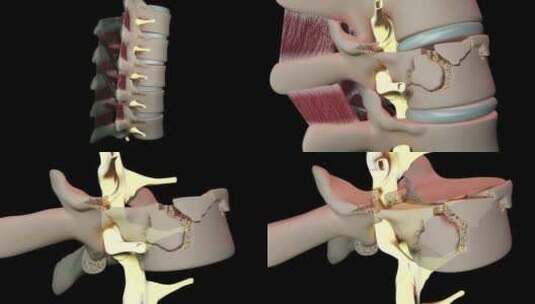 椎体骨折和脊髓损伤高清在线视频素材下载