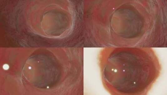 肠道蠕动高清在线视频素材下载
