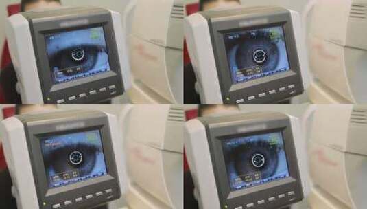 显示在眼科设备屏幕上的眼睛高清在线视频素材下载