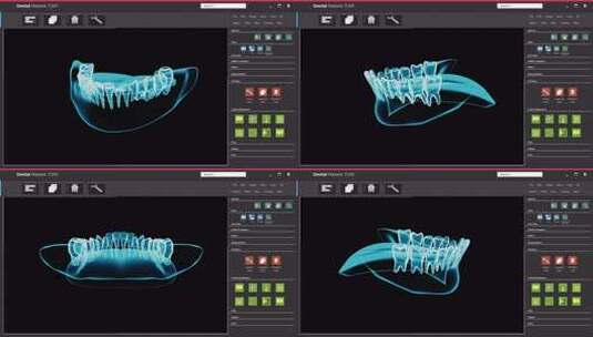 软件应用程序用户界面与牙科X光扫描的界面高清在线视频素材下载