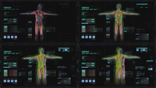 科技医疗人体扫描血管神经骨骼诊断治疗高清在线视频素材下载