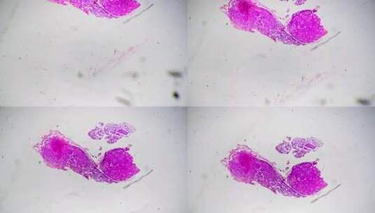 40倍放大显微镜下拍摄的人体脊髓神经节切高清在线视频素材下载