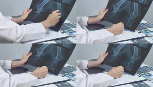 医院的医生和骨骼X光检查高清在线视频素材下载