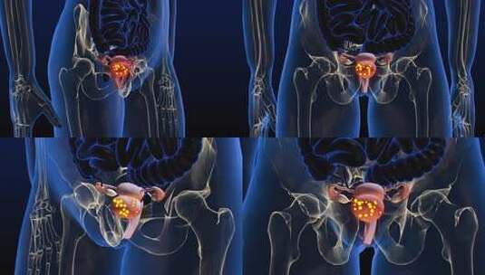 疾病在子宫内扩散 3D 动画高清在线视频素材下载