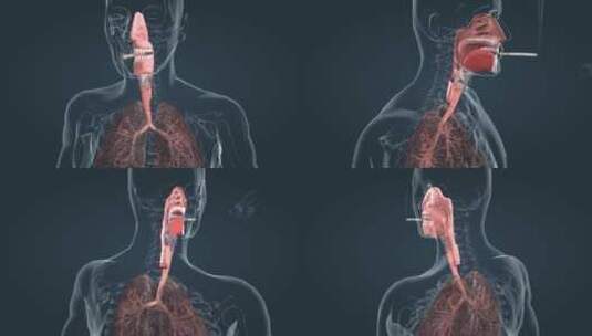 肺癌 肺部 吸烟 抽烟 肺病变 三维动画高清在线视频素材下载
