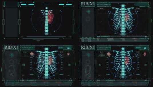 蓝色科技HUD屏幕节目医疗大数据智能界面123高清在线视频素材下载