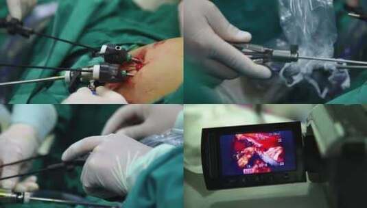手术室手术台 腹腔微创手术 手术准备工作高清在线视频素材下载