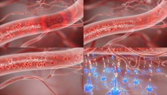 打通血栓 恢复血管弹性  修复大脑神经高清在线视频素材下载