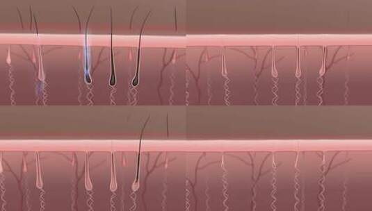 脱毛 激光脱毛 毛囊 收缩毛孔高清在线视频素材下载