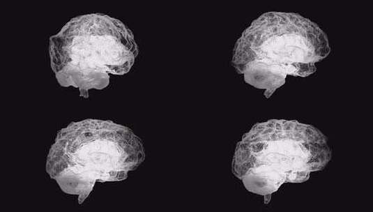 人类白色大脑在黑色，科学解剖背景。人脑就高清在线视频素材下载