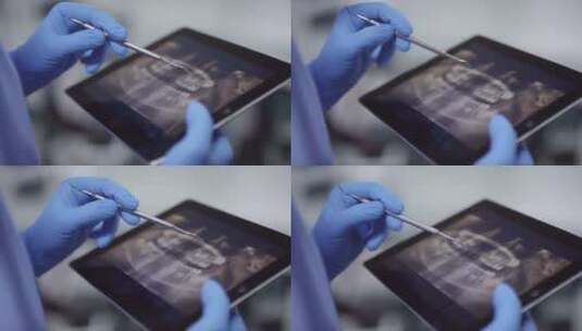 医生拿着平板查看牙齿X光图像高清在线视频素材下载