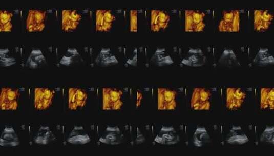 医疗设备的视频墙超声扫描诊断妊娠高清在线视频素材下载