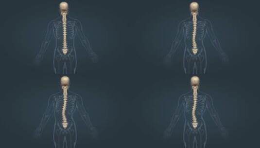 医学人体骨骼骨架脊柱侧弯脊柱疾病三维动画高清在线视频素材下载