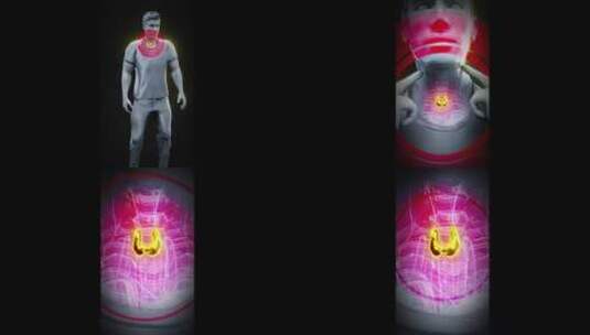 一个人和甲状腺的概念垂直3D动画高清在线视频素材下载