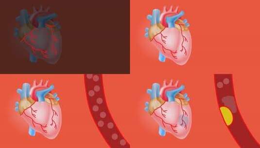 医学医疗人体心脏心血管系统高清在线视频素材下载