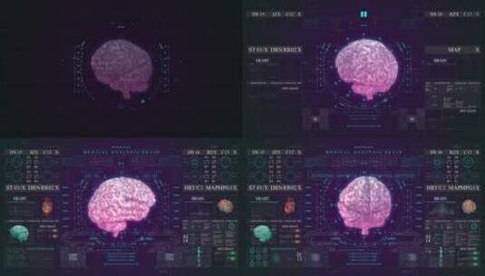 大脑扫描医疗科技显示器智能HUD科技屏幕高清在线视频素材下载
